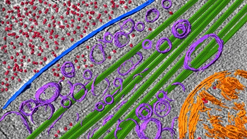 Fitzpatrick2019_cryo-ET-cell_2.jpg